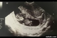 Newborn Announcement Ideas: Creative Ways to Share Your Big News